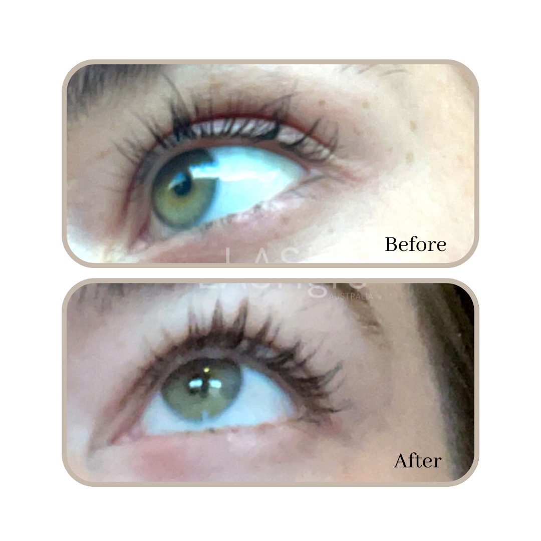 before and after lashgro results