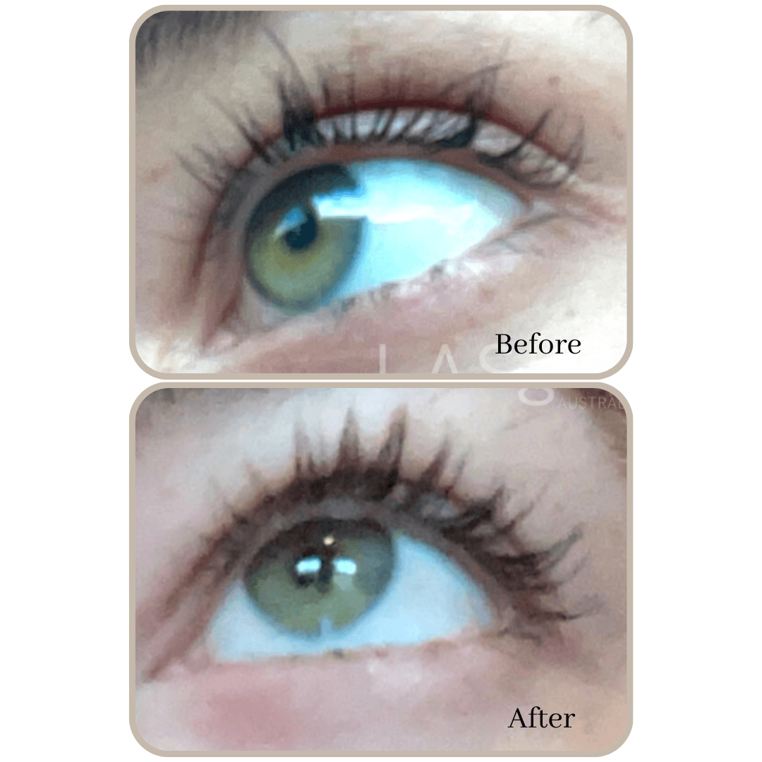 lash serum results before and after