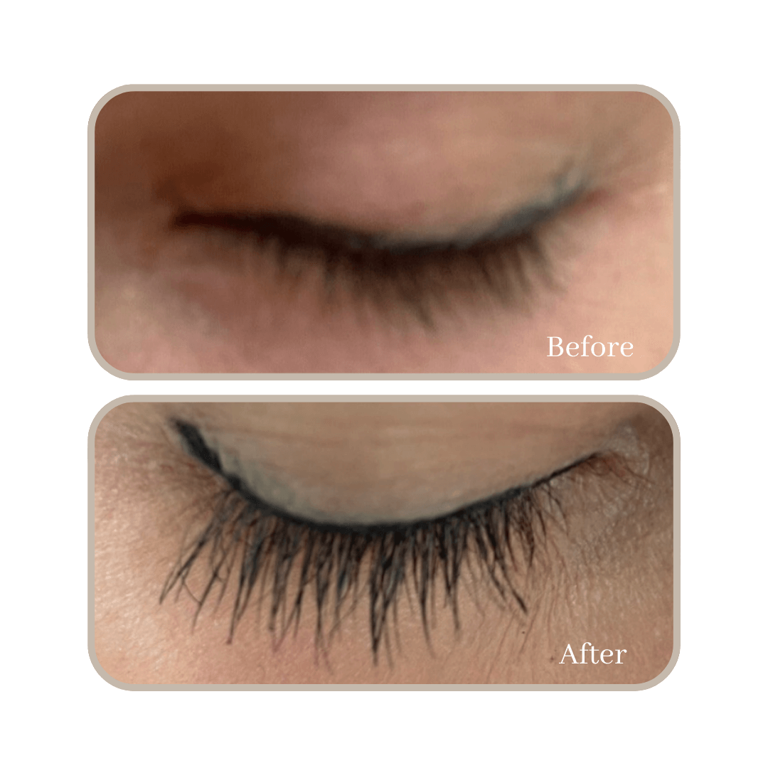 eyelash growth serum results