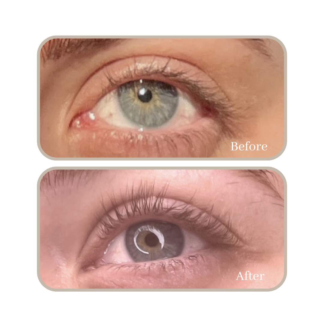 eyelash growth serum results australia