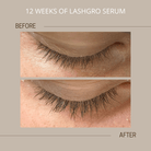 eyelash serum australia